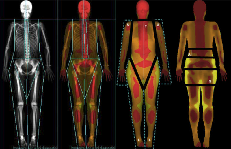 Photo: Medical Spa Palace Merano, Body Composition Analysis (DEXA Scanner)